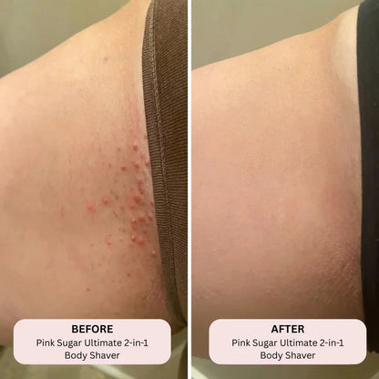 THE ULTIMATE BIKINI TRIMMER - EDOHNEX™